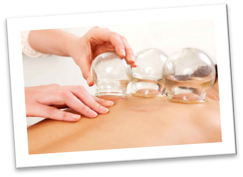 Cupping therapy