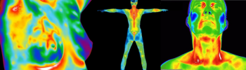 Thermography